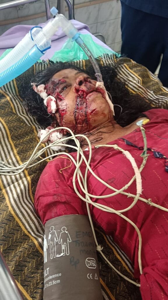 బండరాయితో భార్యపై దాడి.. భర్తపై కేసు